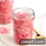 Quick and Easy Pickled Red Onions 6 How to Pickle Red Onion by The BakerMama